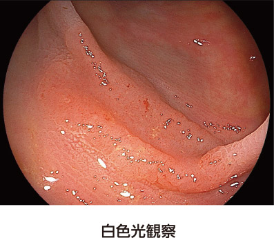 通常の観察画像